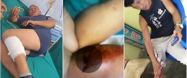 प्रहरीको गोली लागेर विराटनगरमा ६ जना घाइते