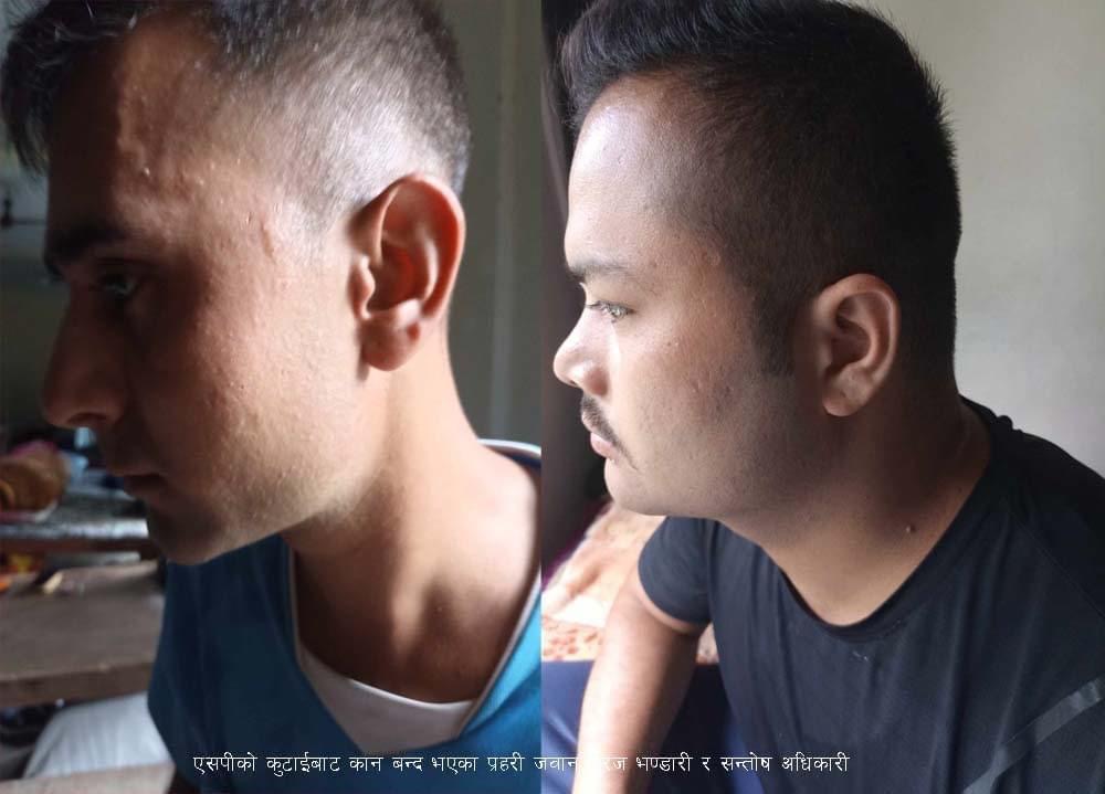 एसपी खड्काले कुट्दा प्रहरी जवानको कानको जाली फुट्यो